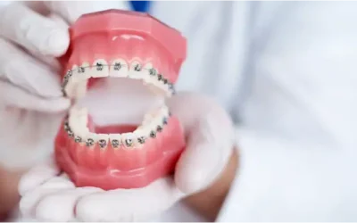 Odontología moderna: tecnología de vanguardia en nuestra clínica dental